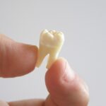 Erek Erek Gigi Copot 2D 3D 4D Menurut Buku Mimpi Terbaru 2025