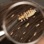 Erek Erek Kutu Rambut 2D 3D 4D Menurut Buku Mimpi Terbaru 2025