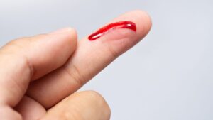 Erek Erek Melihat Darah 2D 3D 4D Menurut Buku Mimpi Terbaru 2025