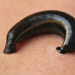 Erek Erek Digigit Lintah Di Kaki 2D 3D 4D Menurut Buku Mimpi Terbaru 2026