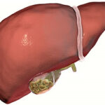 Erek Erek Empedu 2D 3D 4D Menurut Buku Mimpi Terbaru 2025