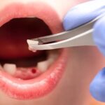 Erek Erek Gigi Copot 2D 3D 4D Menurut Buku Mimpi Terbaru 2026