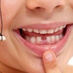 Erek Erek Gigi Copot Bagian Atas 2D 3D 4D Menurut Buku Mimpi Terbaru 2026