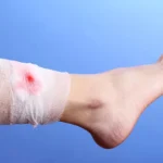 Erek Erek Kaki Berdarah 2D 3D 4D Menurut Buku Mimpi Terbaru 2026