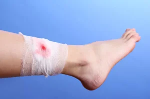 Erek Erek Kaki Berdarah 2D 3D 4D Menurut Buku Mimpi Terbaru 2026