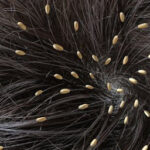 Erek Erek Kutu Rambut 2D 3D 4D Menurut Buku Mimpi Terbaru 2026