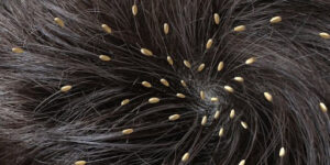 Erek Erek Kutu Rambut 2D 3D 4D Menurut Buku Mimpi Terbaru 2026