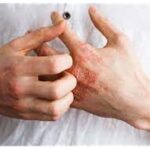 Erek Erek Sakit Gudig 2D 3D 4D Menurut Buku Mimpi Terbaru 2025