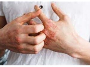 Erek Erek Sakit Gudig 2D 3D 4D Menurut Buku Mimpi Terbaru 2025