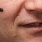 Erek Erek Tahi Lalat 2D 3D 4D Menurut Buku Mimpi Terbaru 2025